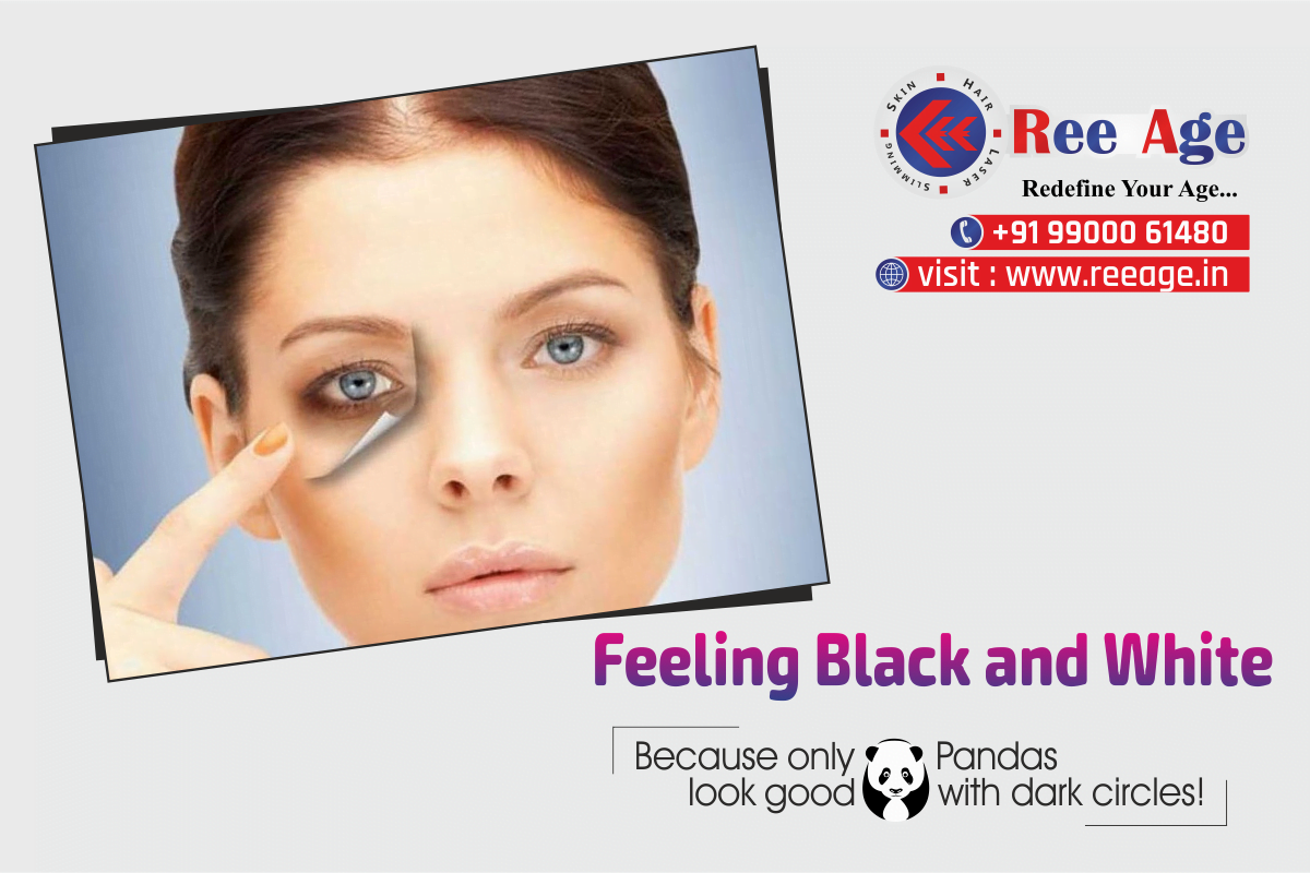 Feeling Black and White Tips to remove Dark eyes