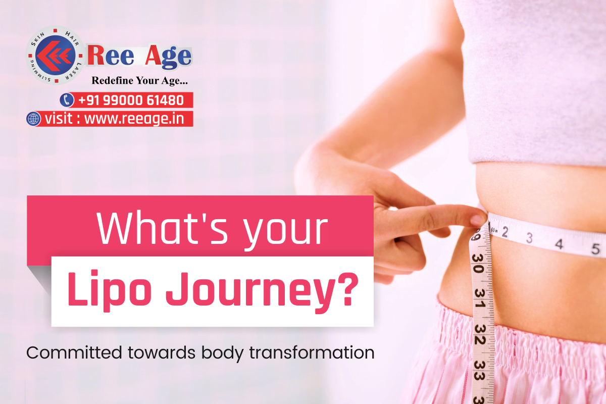 Laser Lipolysis is modern take on the traditional liposuction technique which was highly invasive and took days for the body to heal and show the full effect