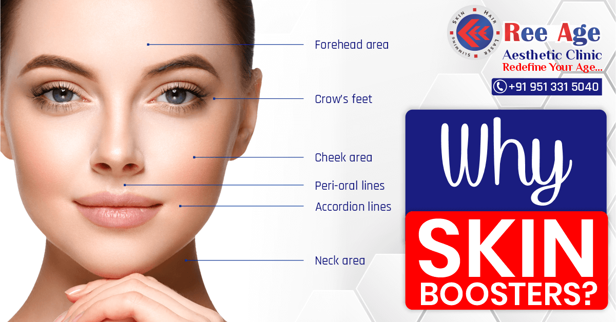 Why Skin Boosters?