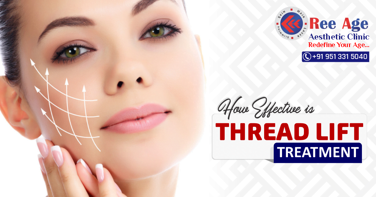 How effective is thread lift treatments?